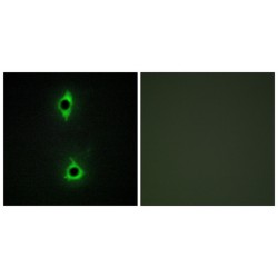 1-Phosphatidylinositol 3-Phosphate 5-Kinase (PIP5K) Antibody