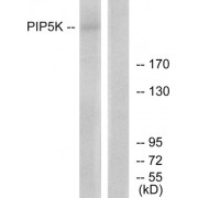 Western blot analysis of extracts from HepG2 cells, using PIP5K antibody.