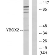 Western blot analysis of extracts from COLO205 cells, using YBOX2 antibody.