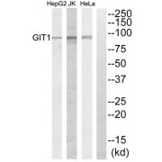 Western blot analysis of extracts from HeLa cells, Jurkat cells and HepG2 cells, using GIT1 antibody.