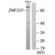 Western blot analysis of extracts from HeLa cells, using ZNF337 antibody.