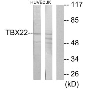 Western blot analysis of extracts from HUVEC cells and Jurkat cells, using TBX22 antibody.