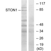 Western blot analysis of extracts from K562 cells, using STON1 antibody.
