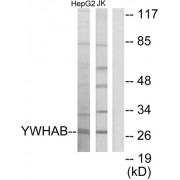 Western blot analysis of extracts from HepG2 cells and Jurkat cells, using 14-3-3 beta antibody.