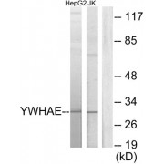 14-3-3 Protein Epsilon (YWHAE) Antibody