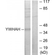 Western blot analysis of extracts from Jurkat cells, using 14-3-3 eta antibody.