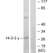 Western blot analysis of extracts from K562 cells, treated with insulin (0.01U/ml, 15mins), using 14-3-3 gamma antibody.