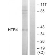 Western blot analysis of extracts from 293 cells, treated with insulin (0.01U/ml, 15mins), using 5-HT-4 antibody.