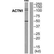 Alpha Actinin 1 (ACTN1) Antibody
