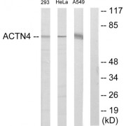 Western blot analysis of extracts from 293 cells, HeLa cells and A549 cells, using ACTN4 antibody.