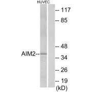 abx013903