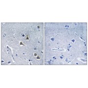 Immunohistochemistry analysis of paraffin-embedded human brain tissue, using ARRDC2 antibody.