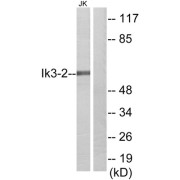 Western blot analysis of extracts from Jurkat cells, using Ik3-2 antibody.