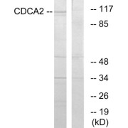 Western blot analysis of extracts from 293 cells, using CDCA2 antibody.