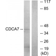 Western blot analysis of extracts from K562 cells, using CDCA7 antibody.