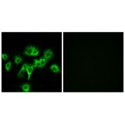 Immunofluorescence analysis of MCF-7 cells, using CDON antibody.