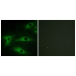 Collagen Type I Alpha 2 (COL1A2) Antibody