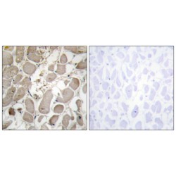 Collagen Type V Alpha 1 (COL5A1) Antibody