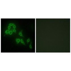 Collagen Type V Alpha 2 (COL5A2) Antibody