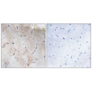 Immunohistochemistry analysis of paraffin-embedded human skeletal muscle tissue using COL12A1 antibody.