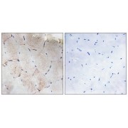 IHC-P Human skeletal muscle tissue using COL12A1 antibody. The image on the right was blocked with the corresponding peptide.