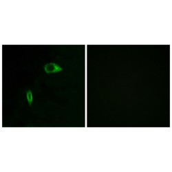 Collagen Type XIV Alpha 1 (COL14A1) Antibody