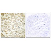 Immunohistochemistry analysis of paraffin-embedded human heart tissue using COL14A1 antibody. The picture on the right is blocked with the synthesized peptide.
