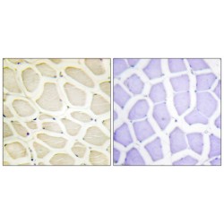 Collagen Type XX Alpha 1 (COL20A1) Antibody