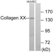 Western blot analysis of extracts from HUVEC cells, using COL20A1 antibody.