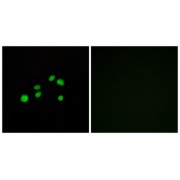 Immunofluorescence analysis of HepG2 cells, using COL23A1 antibody.
