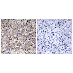 COX17, Cytochrome C Oxidase Copper Chaperone (COX17) Antibody