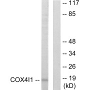 Western blot analysis of extracts from A549 cells, using COX41 antibody.