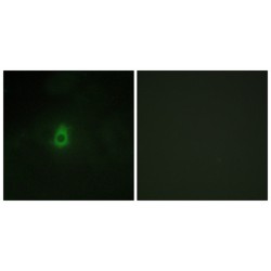 Cytochrome P450 2E1 (CYP2E1) Antibody