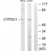 Western blot analysis of extracts from HeLa cells and Lovo cells, using CYP2U1 antibody.