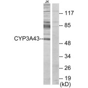 Western blot analysis of extracts from Jurkat cells, using CYP3A43 antibody.