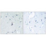 Immunohistochemistry analysis of paraffin-embedded human brain tissue using CYP3A4 antibody.