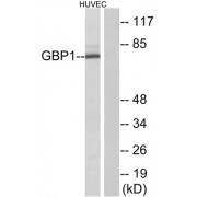 Western blot analysis of extracts from HUVEC cells, using GBP1 antibody.