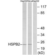 Western blot analysis of extracts from HepG2 cells and HeLa cells, using HSPB2 antibody.