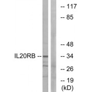 Western blot analysis of extracts from HeLa cells, using IL20RB antibody.