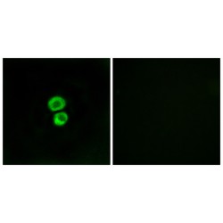 Interferon-Induced Transmembrane Protein 3 (IFM3) Antibody