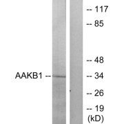 Western blot analysis of extracts from RAW264.7 cells, treated with TNF (20ng/ml, 5mins), using PRKAB1 antibody.