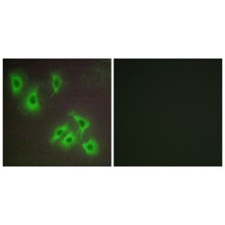 Apoptosis Regulator Bcl-W (BCL2L2) Antibody