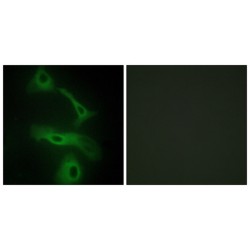 Clusterin (CLUS) Antibody