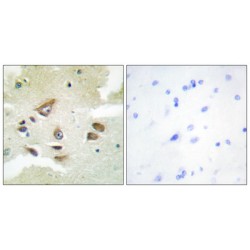 Clusterin (CLUS) Antibody