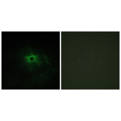 Laminin Subunit Alpha 4 (LAMA4) Antibody