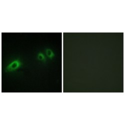 Laminin, Beta 1 (LAMB1) Antibody