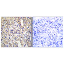Laminin, Beta 1 (LAMB1) Antibody