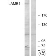 Western blot analysis of extracts from HepG2 cells, using LAMB1 antibody.