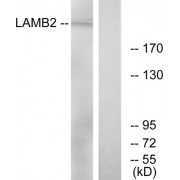 Western blot analysis of extracts from RAW264.7 cells, using LAMB2 antibody.