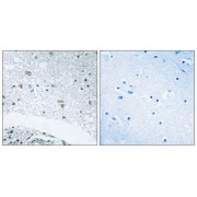 Immunohistochemistry analysis of paraffin-embedded human brain tissue using LAMC3 antibody.